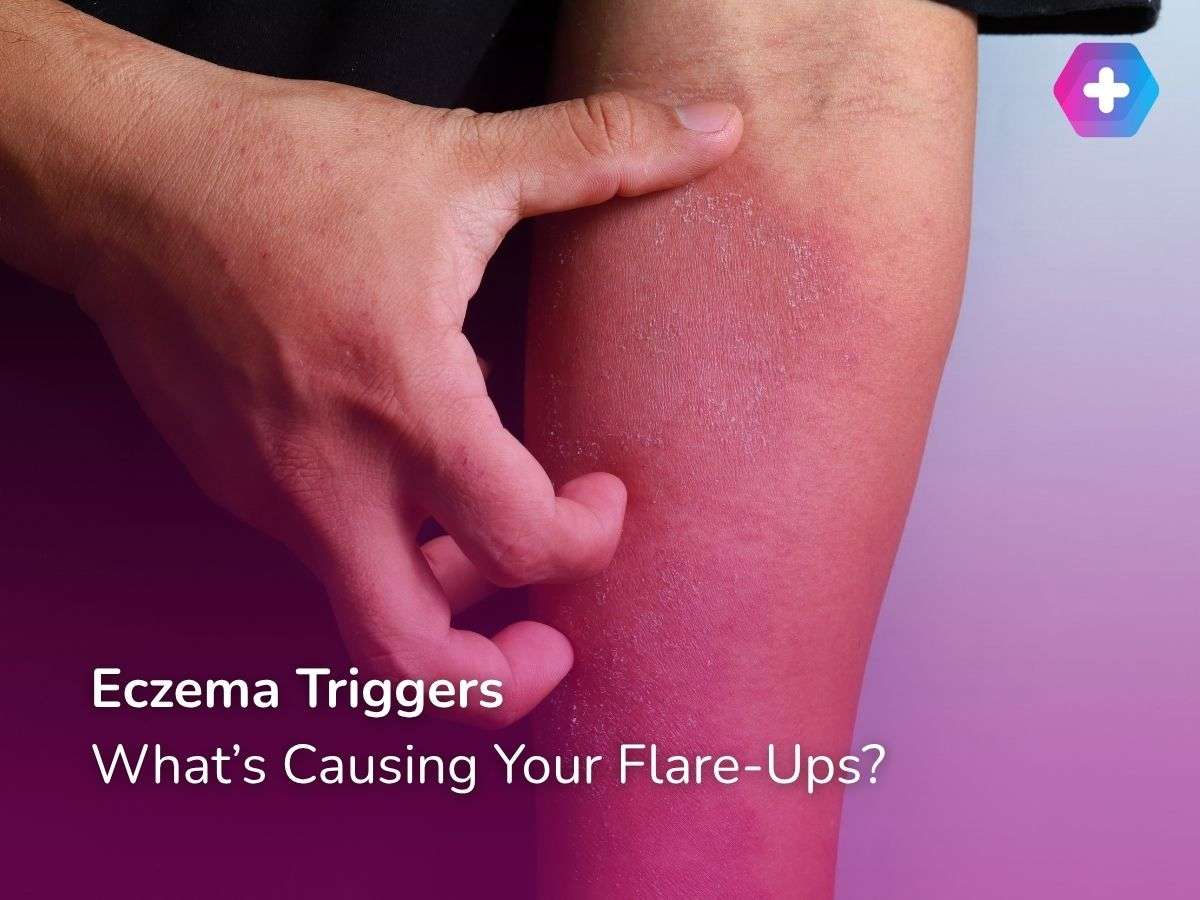 Eczema Triggers: What’s Causing Your Flare-Ups?
