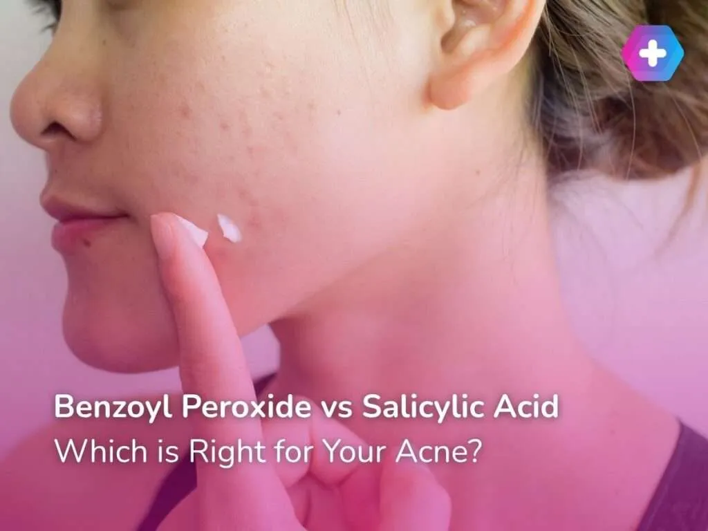 Benzoyl Peroxide vs Salicylic Acid: Which is Right for Your Acne?