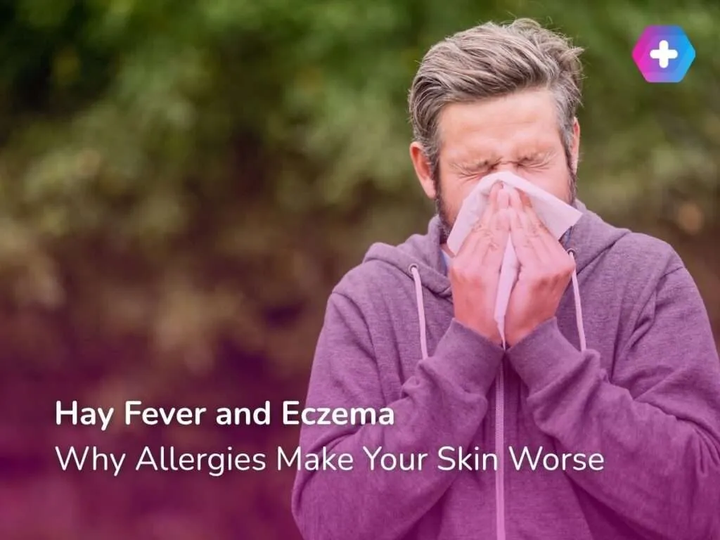 Hay Fever and Eczema: Why Allergies Make Your Skin Worse