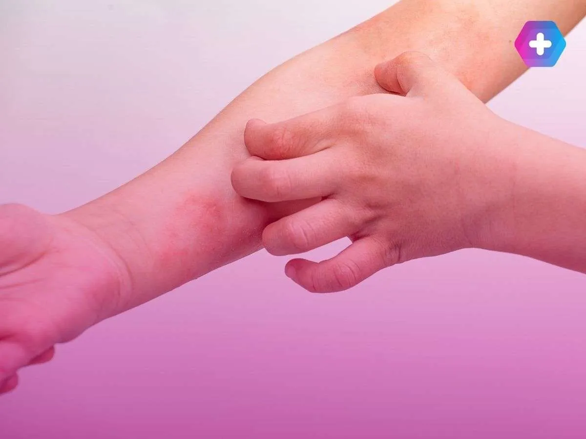 person scratching eczema rash on their arm